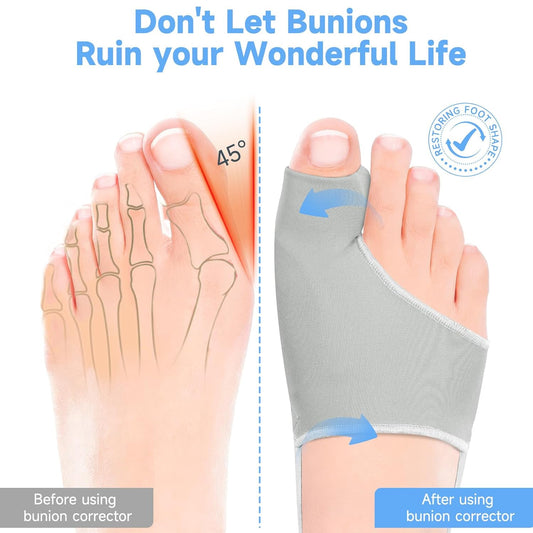 Corrector de juanetes (Hallux Valgus) para dedo gordo HYGGEAR
