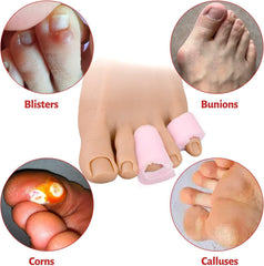 Hyggear™ Hammer Toe Fix - Manga para dedos en martillo con rollo de tamaño mediano superpuesto, protectores de esponja para dedos en martillo - 23329353031
