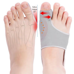 HYGGEAR CORRECTOR DE JUANETES Y HALLUX VALGUS PARA DEDO GORDO DEL PIE